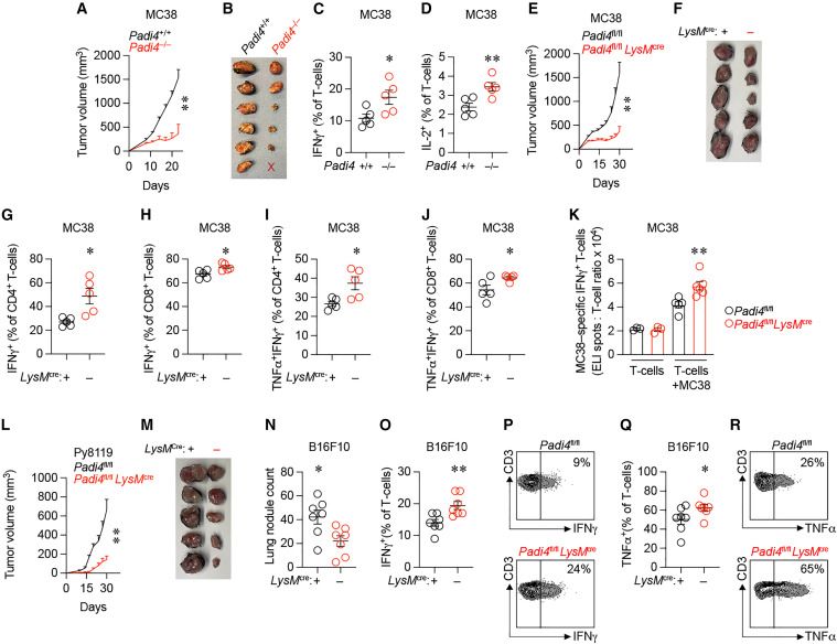 PAD4 in macrophages negatively regulates anti-tumor immunity.