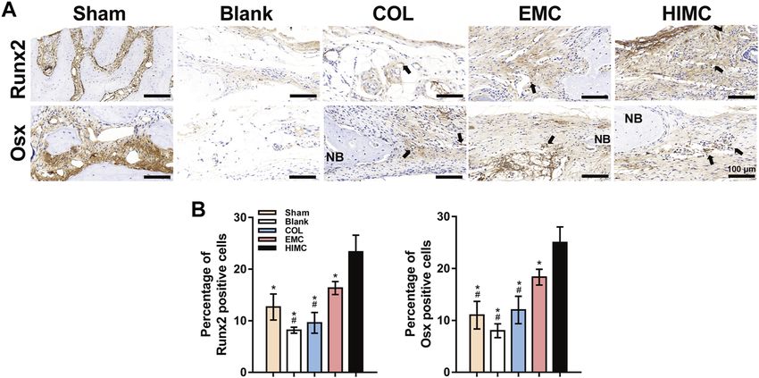 Representative images of IHC staining for osteogenesis markers in the defect region of different groups.