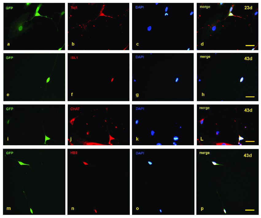 Detection of motor neuron markers with immunofluorescence staining.