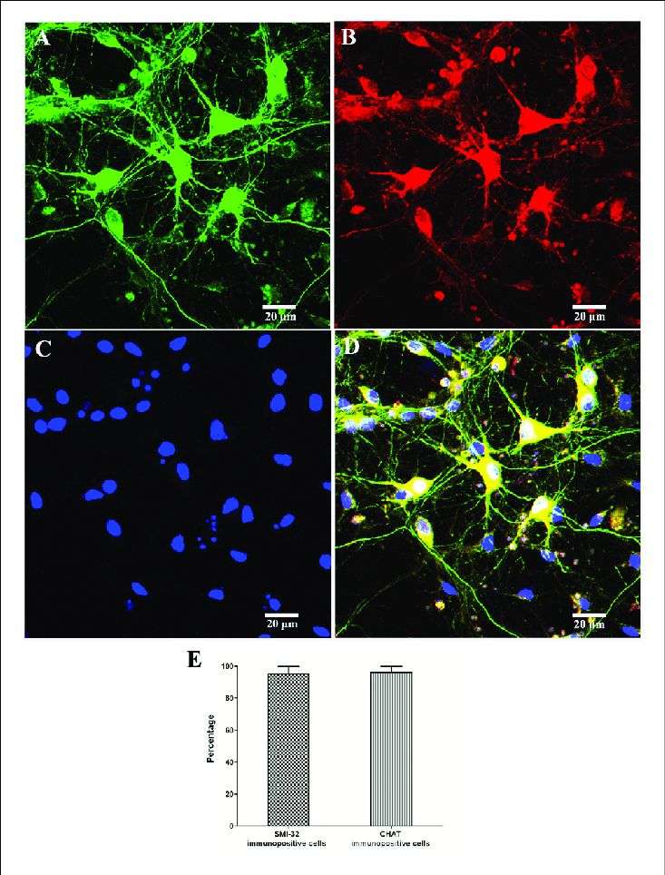 Identification and purity of SMNs by immunofluorescence with motor neuron-specific markers against SMI-32 and CHAT.