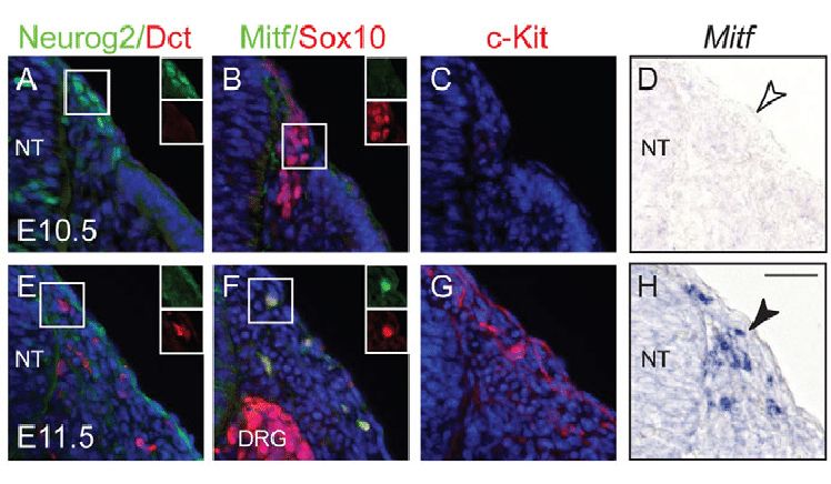 Sequential expression of sensory and melanocyte markers in neural crest cells.