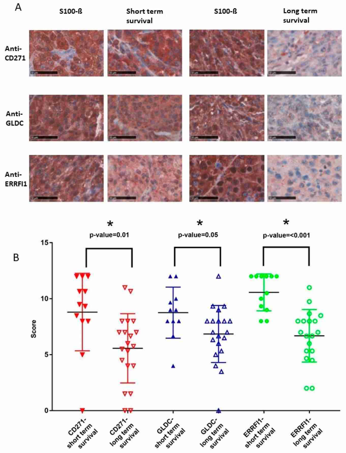 Neural crest markers CD271, GLDC, and ERRFI1 are highly expressed in advanced melanoma patients with bad prognosis.