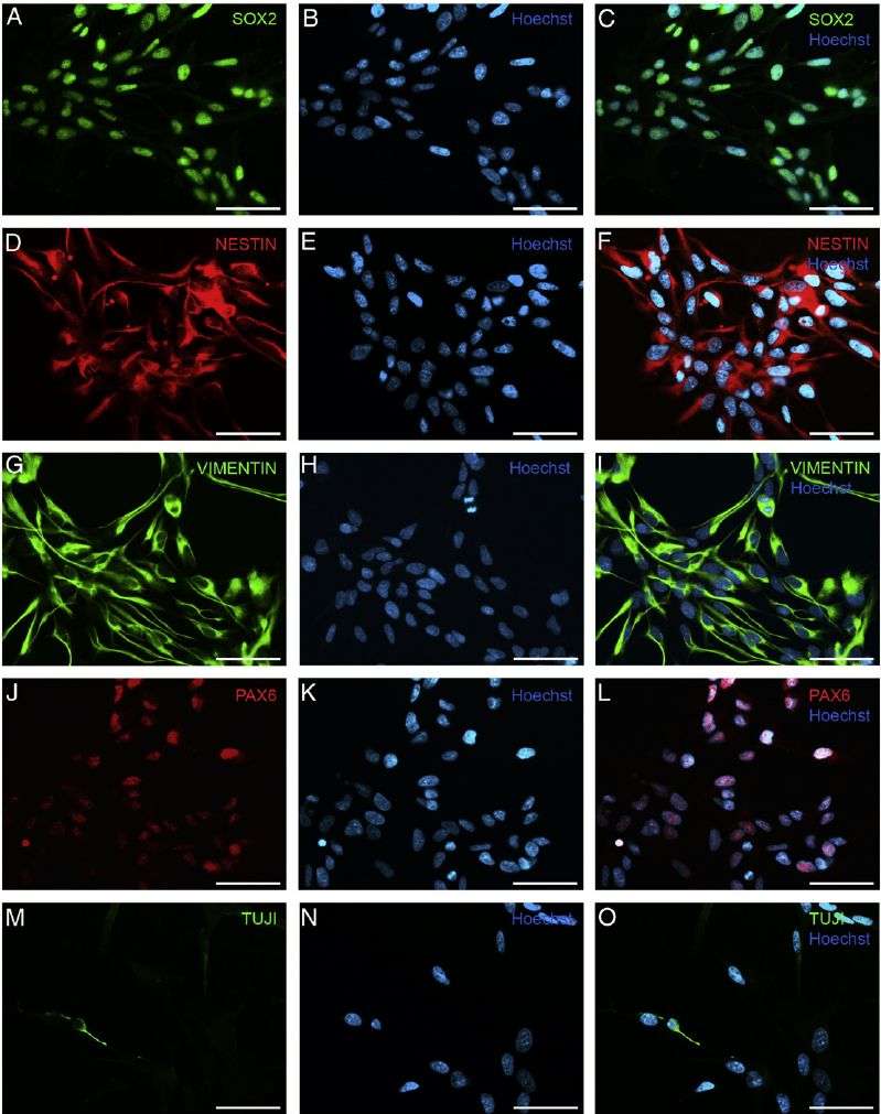 Immunocytochemistry of neural progenitor cells (NPCs).