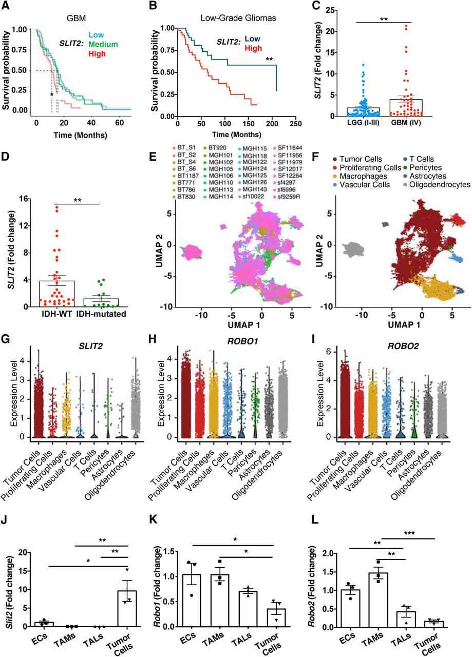 Slit2 expression correlates with glioma aggressiveness and poor patient prognosis.